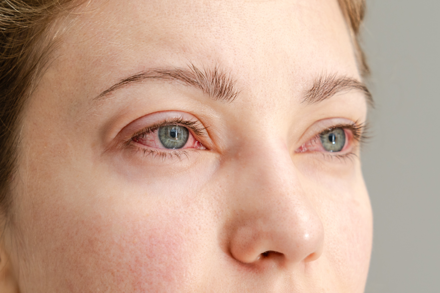 Person with red eyes.