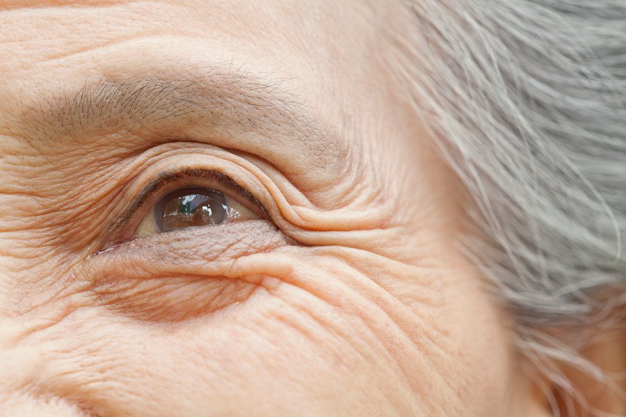 Healthy eye.