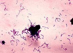 strep